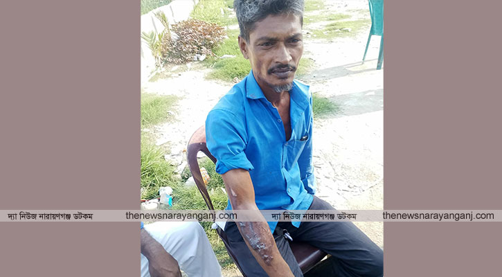 ঝুট ব্যবসার দ্বন্দ্ব তাঁতী দল সভাপতির মাথায় ১৮ সেলাই