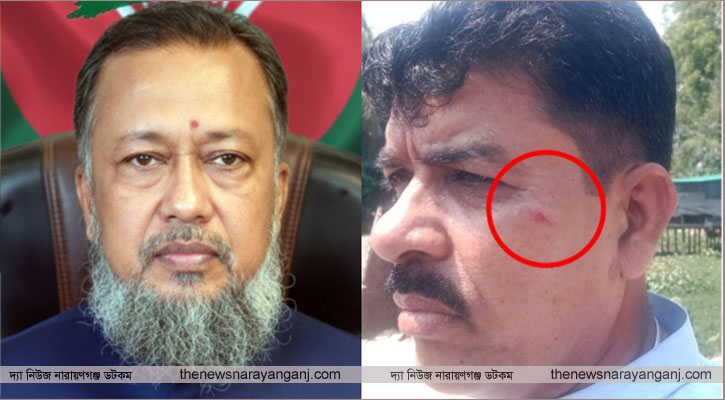 বিএনপির সেক্রেটারীকে ঘুষি দেওয়ার অভিযোগ টিপুর বিরুদ্ধে