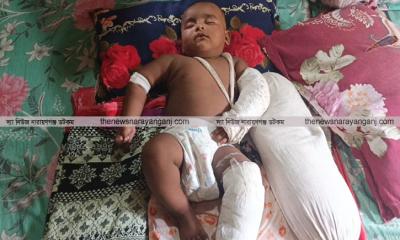 আট মাসের শিশুর হাত পা ভেঙে পালিয়েছে মা
